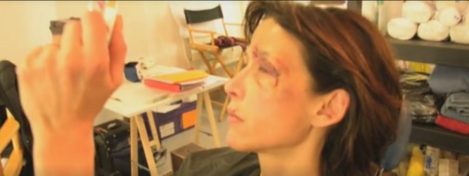 Sophie Marceau le visage tuméfié