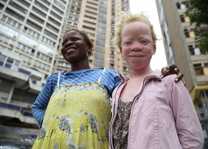 "Miss et Mister albinos" au Kenya