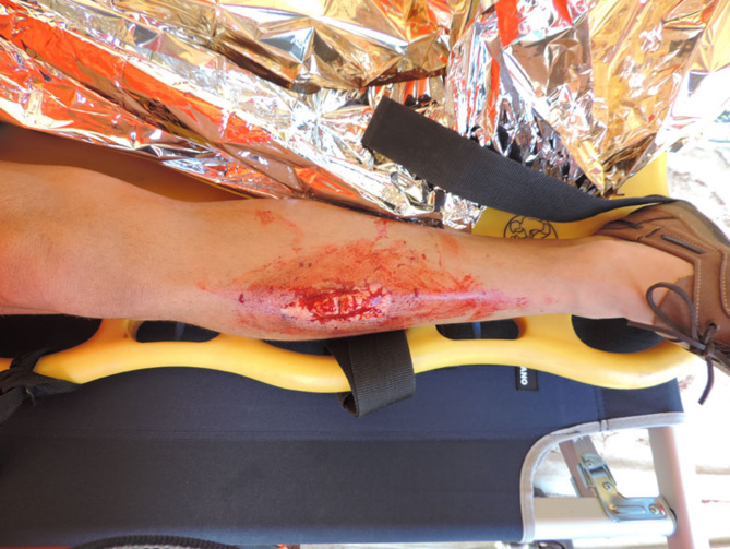 Catastrophe au Stade de La Redoute... Un exercice grandeur nature Catastrophe au Stade de La Redoute... Un exercice grandeur nature