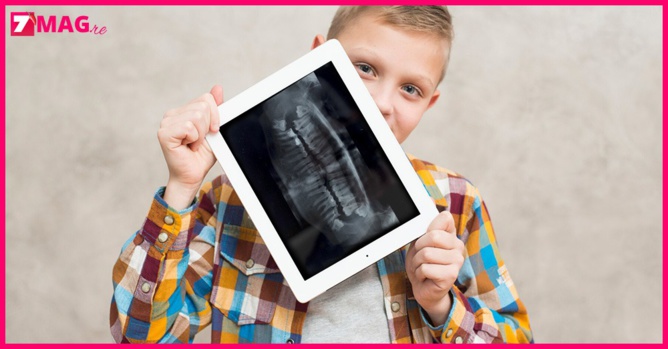 À 7 ans il se fait retirer 526 dents À 7 ans il se fait retirer 526 dents