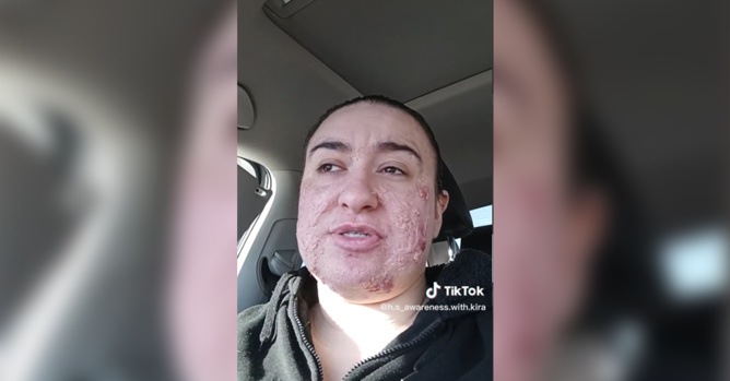 @h.s_awareness.with.kira sur TikTok @h.s_awareness.with.kira sur TikTok