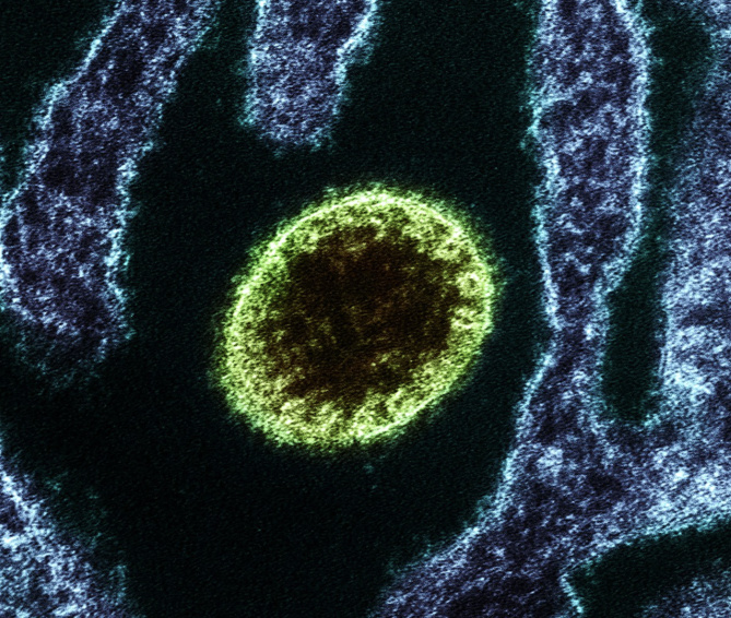 Le virus Nipah, la nouvelle pandémie?