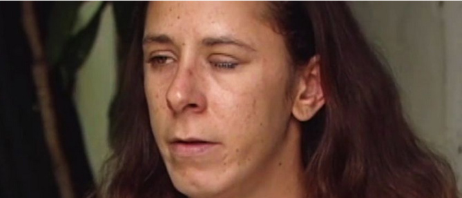 Il lui met de la glue dans l'oeil confondant avec du collyre Il lui met de la glue dans l'oeil confondant avec du collyre