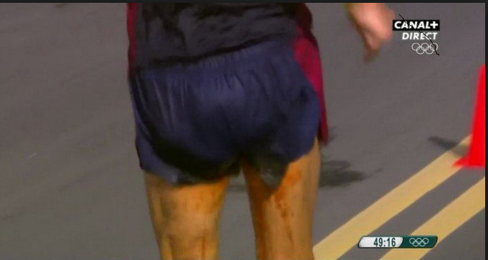 Problèmes intestinaux aux JO : mieux vaut en rire!