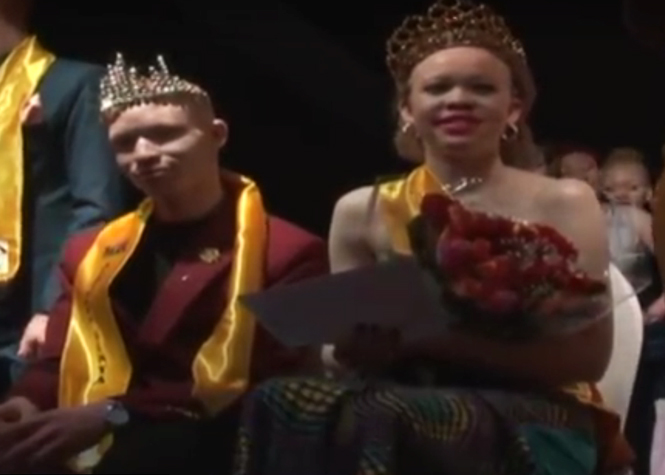 "Miss et Mister albinos" au Kenya