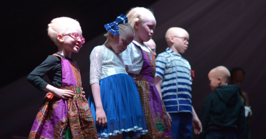 "Miss et Mister albinos" au Kenya