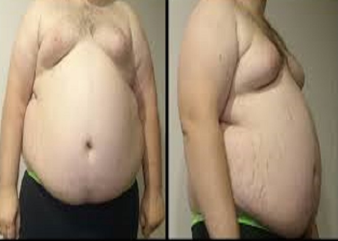 Un français sur deux de plus de 30 ans en surpoids!