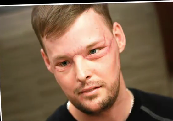 Un nouveau visage, pour une nouvelle vie