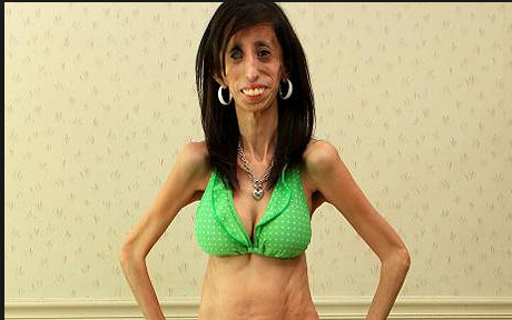 La leçon d'espérance de la femme la plus laide du monde