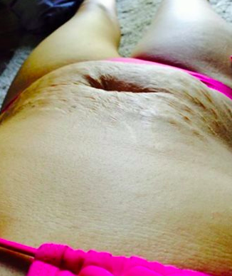 Le ventre de Tanis qui a suscité des commentaires désagréables de quelques adolescents