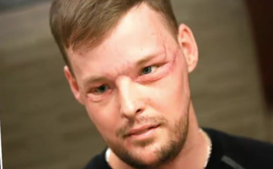 Un nouveau visage, pour une nouvelle vie