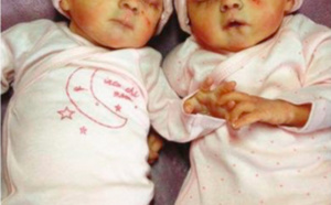 La sordide annonce des jumeaux battus ou décédés