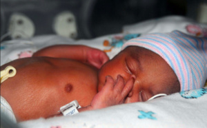 Un prématuré de 268 grammes survit