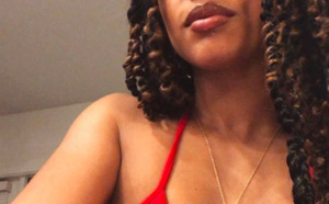 [VIDEO] Après une chute et de graves blessures, la danseuse de pole dance continue le show