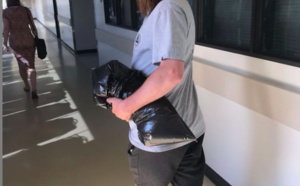 Il garde les os de son bras amputé et les met en scène