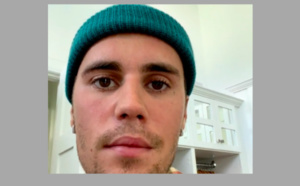 Paralysé au visage, Justin Bieber va reprendre sa tournée