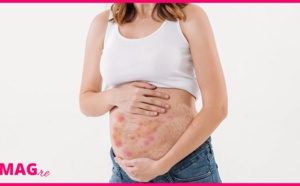 Cette femme enceinte est allergique à son bébé