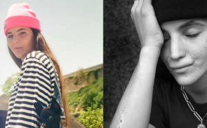 Une influenceuse défigurée par un chien montre sa transformation après six interventions chirurgicales