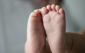 Une petite fille naît en Inde avec 14 doigts et 12 orteils