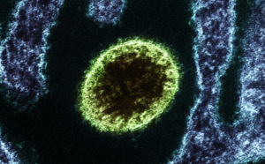 Le virus Nipah, la nouvelle pandémie?