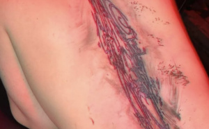Billie Eilish dévoile un immense tatouage abstrait sur son dos
