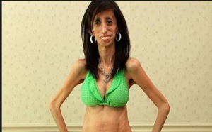 La leçon d'espérance de la femme la plus laide du monde