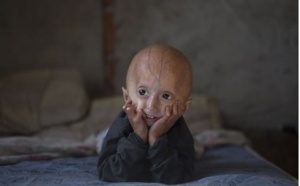 Le drame de l'enfant-vieillard