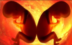 Son frère mort dans son ventre!