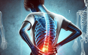 Le mal de dos, une fatalité ?