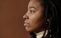 Acné : ce que l’emplacement de vos boutons peut révéler